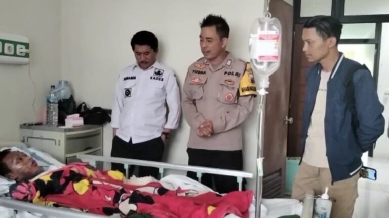 Bermain Api, GJ Remaja Desa Gemeksekti Alami Luka Bakar Sekujur Tubuhnya